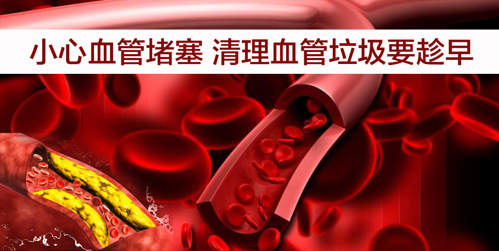 當(dāng)心！這幾類人群血管最易堵，適當(dāng)補(bǔ)硒遠(yuǎn)離血管疾病