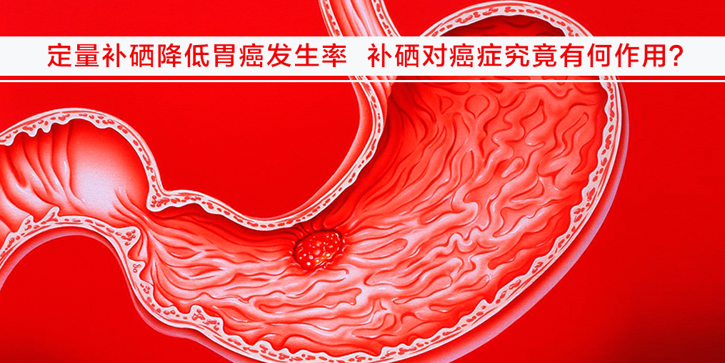 遠(yuǎn)離胃癌不難，改變不良習(xí)慣外多補(bǔ)硒