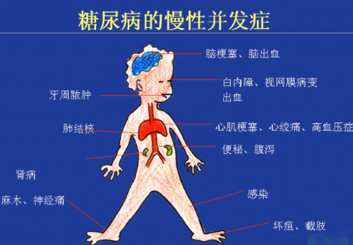 你還在害怕高血糖嗎？科學補硒不“恐糖”