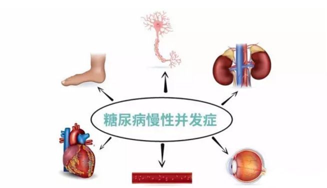 血糖波動(dòng)大，并發(fā)癥來(lái)得快，糖友要多補(bǔ)硒